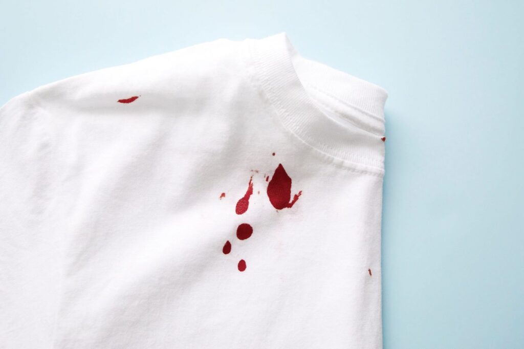 how to remove blood stains