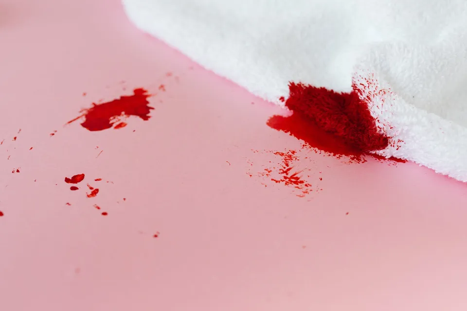 How to Clean Blood from Upholstery? Home Remedies & Steps