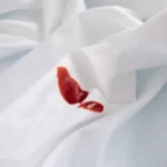 Can Dry Cleaning Remove Dried Blood? Benefits and Limitations