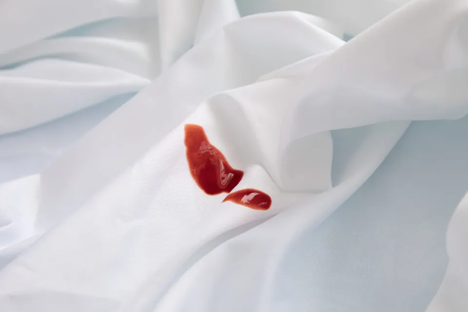Can Dry Cleaning Remove Dried Blood? Benefits and Limitations